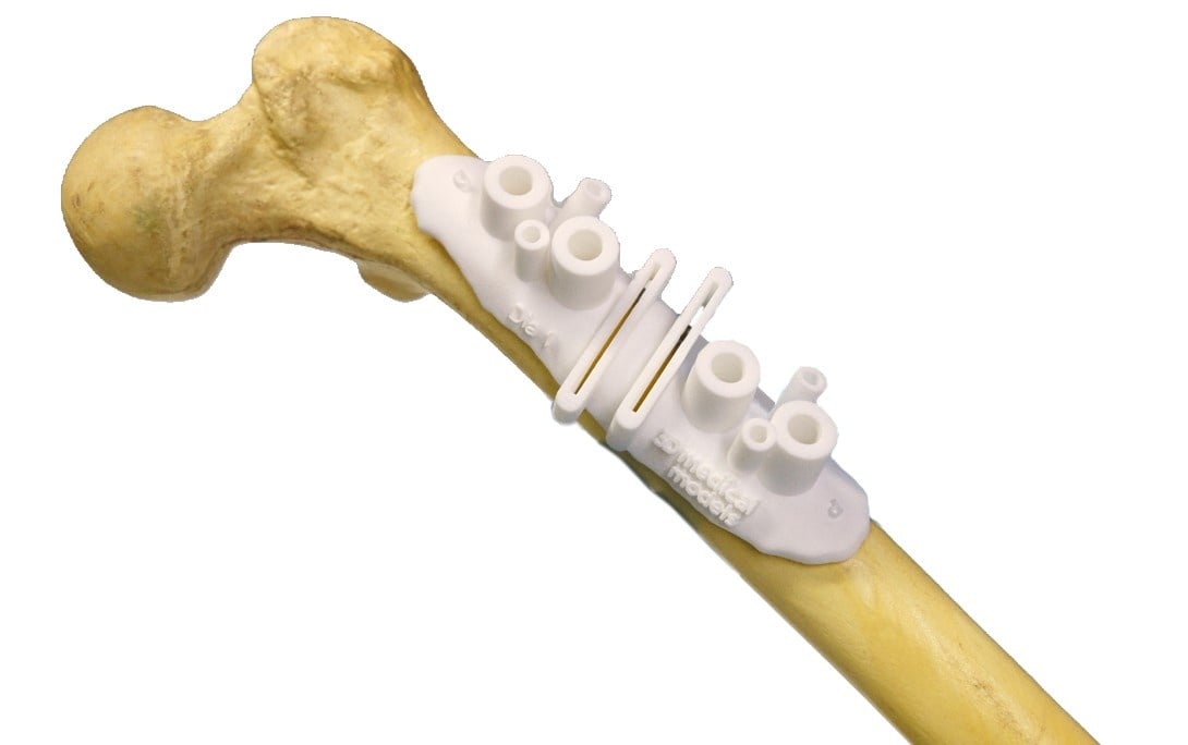 Compliant custom made devices BAAT Medical