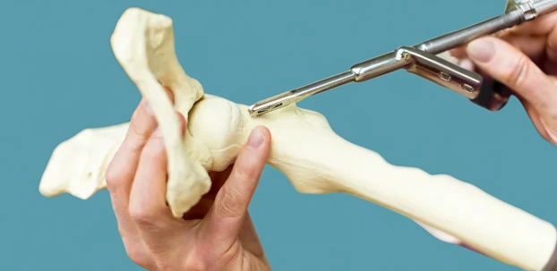 ce mark medical device requirements example implantable medical device