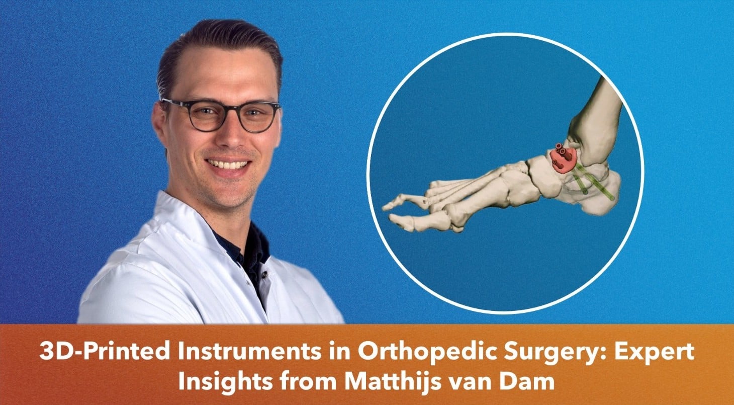 Erik van de Garde interviewing Matthijs van Dam about 3D-printed patient-specific instruments