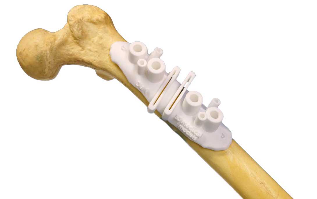 3D-printed patient-specific medical device instrument